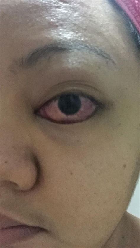Humihingi po ako ng tulong pinansyal para sa medical na .